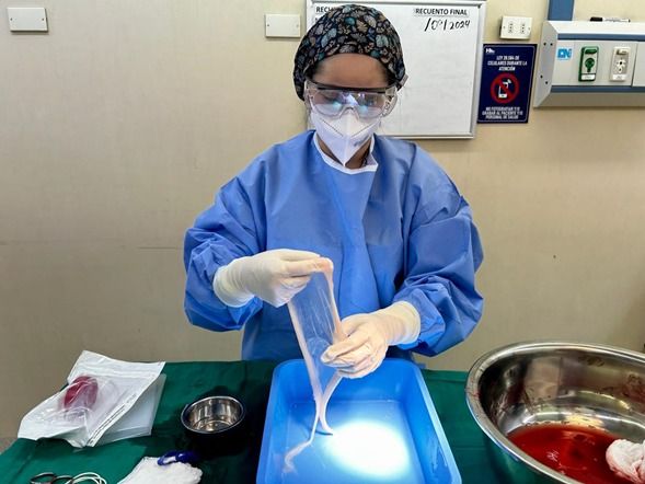 El Hospital Dr. Hernán Henríquez Aravena realiza un hito clínico al separar la membrana amniótica de una placenta para fines médicos