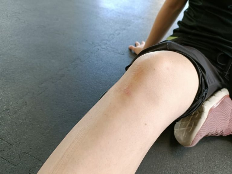 Lesiones de rodilla en el deporte: Cómo enfrentarlas y prevenirlas 
