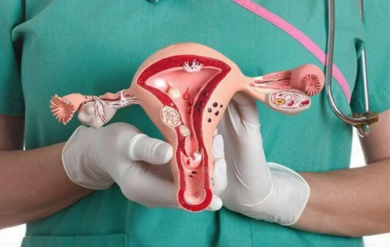 Día Mundial contra el Cáncer Cervicouterino: Más de 1.500 nuevos diagnósticos y cerca de 600 muertes por año en Chile
